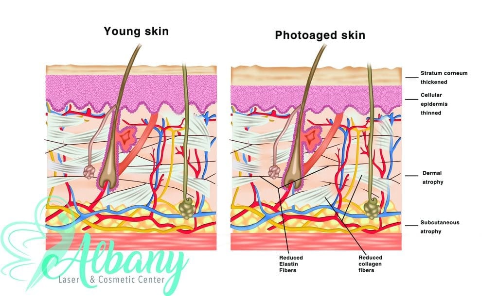 skin aging