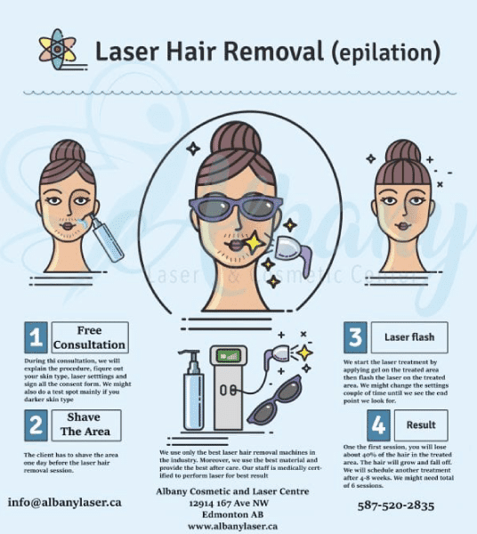 laser hair removal infographic