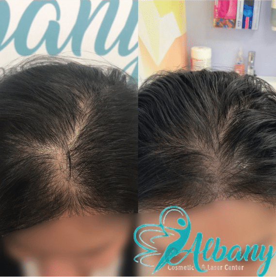 restore your hair naturally