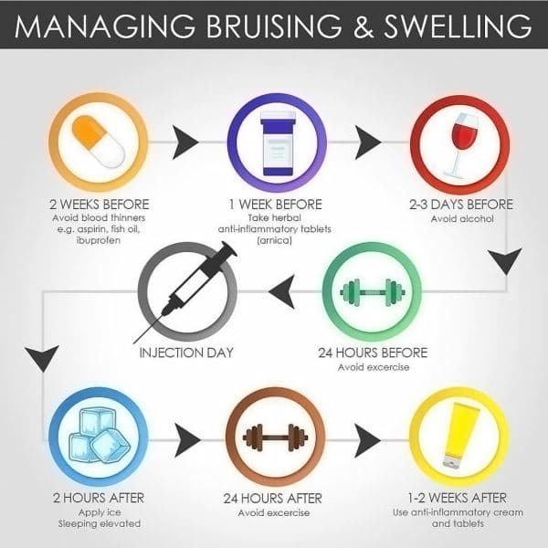 bruising management infographics 
