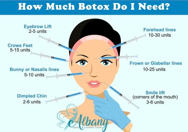 How Much Botox do I need