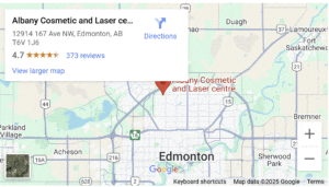 Map showing the location of Albany Cosmetic and Laser Centre in Edmonton at 12914 167 Ave NW, Edmonton, AB, with a rating of 4.7 stars based on 373 reviews.