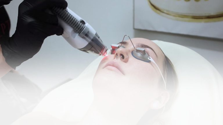 Fraxel Laser Skin Rejuvenation at Albany Cosmetic & Laser Center and medical spa in Edmonton