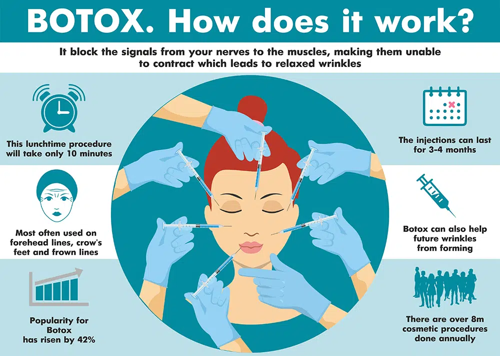Infographics Cosmetic Botulinum Toxin injections