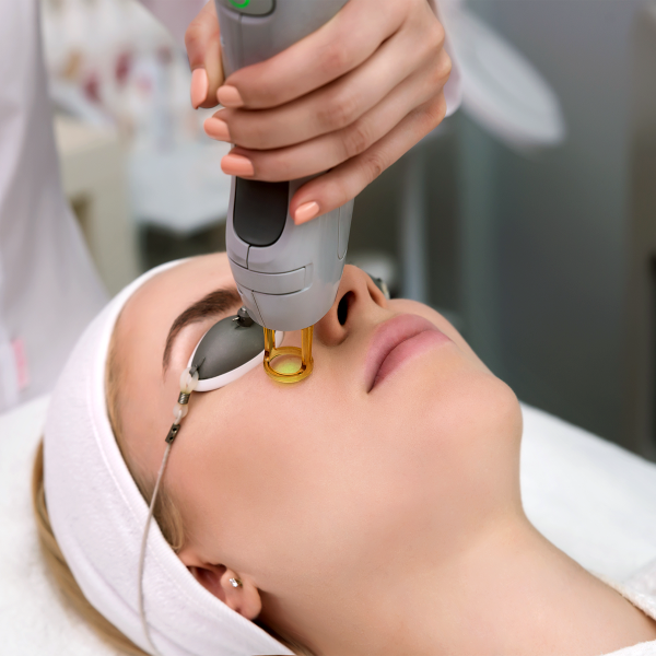 Laser Treatments