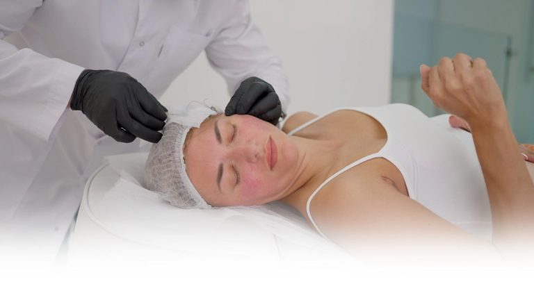 Thread lift at Albany Cosmetic and Laser Centre in Edmonton-Thumbnail