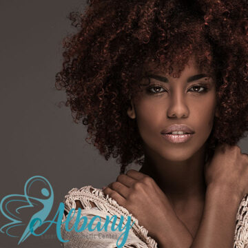 acne scars treatment Edmonton