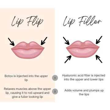 lip flip vs ip filler