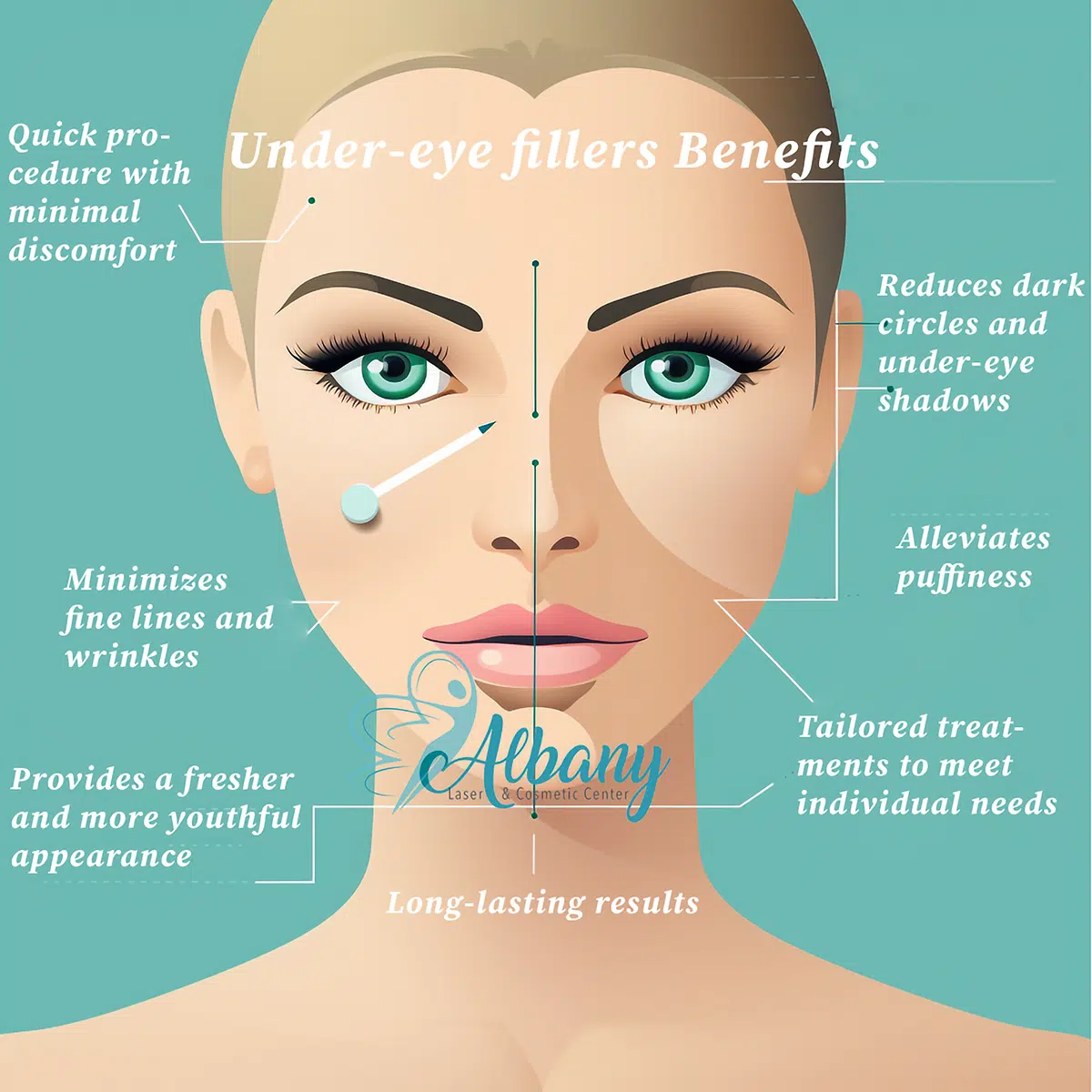 Under-Eye Fillers Infographic